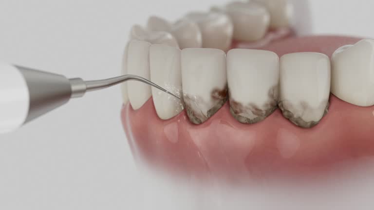 Reliable Wisdom Tooth Removal contractor in Scott County County, KS by Dentist Open Now
